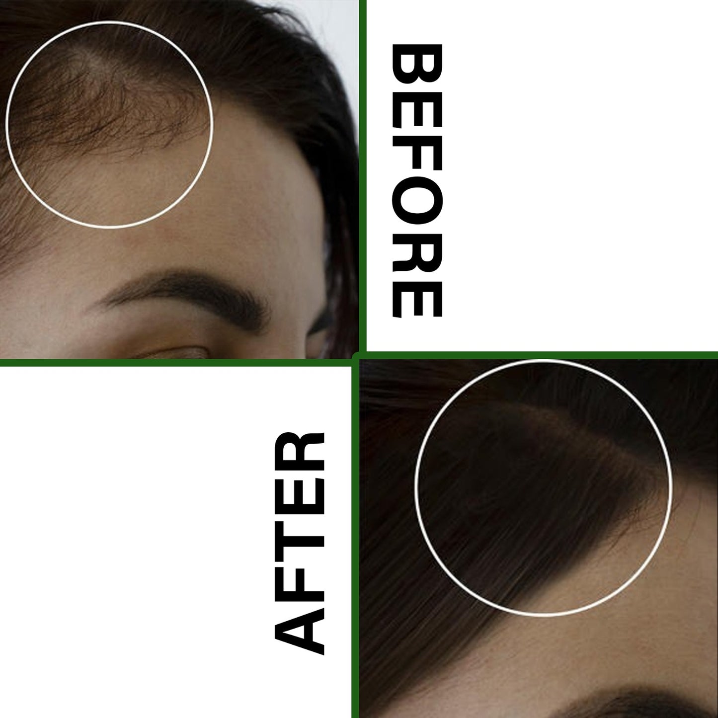 Anti Hair Loss & Regrowth Shampoo