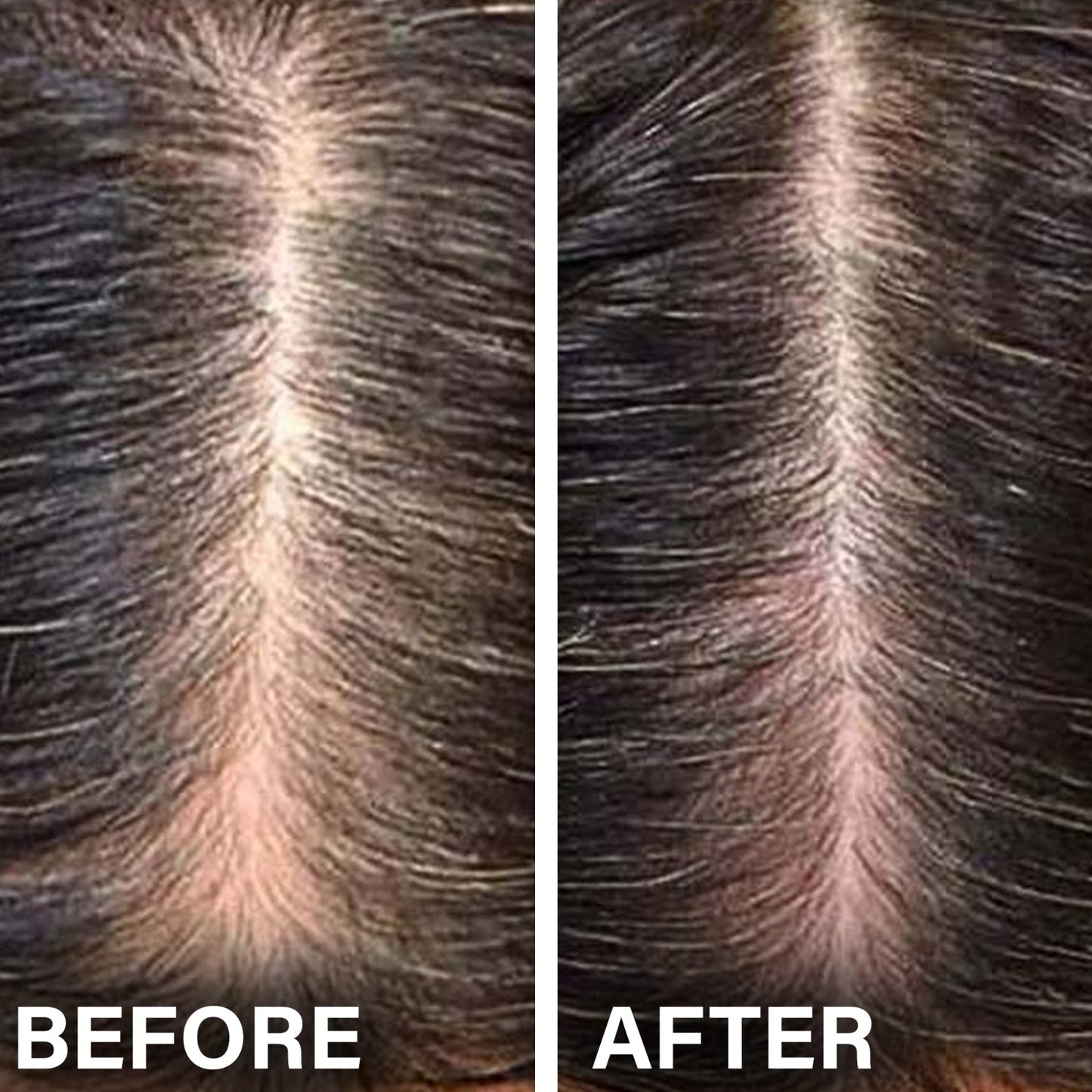 Anti Hair Loss & Regrowth Shampoo