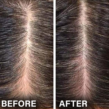 Anti Hair Loss & Regrowth Shampoo